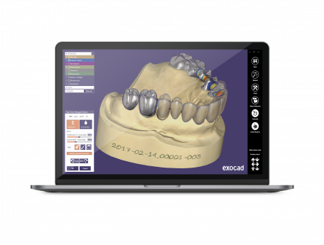 EXOCAD Dental CAD