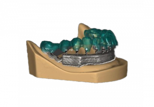 Formation CAO Dentaire Exocad : suprastructures sur barre