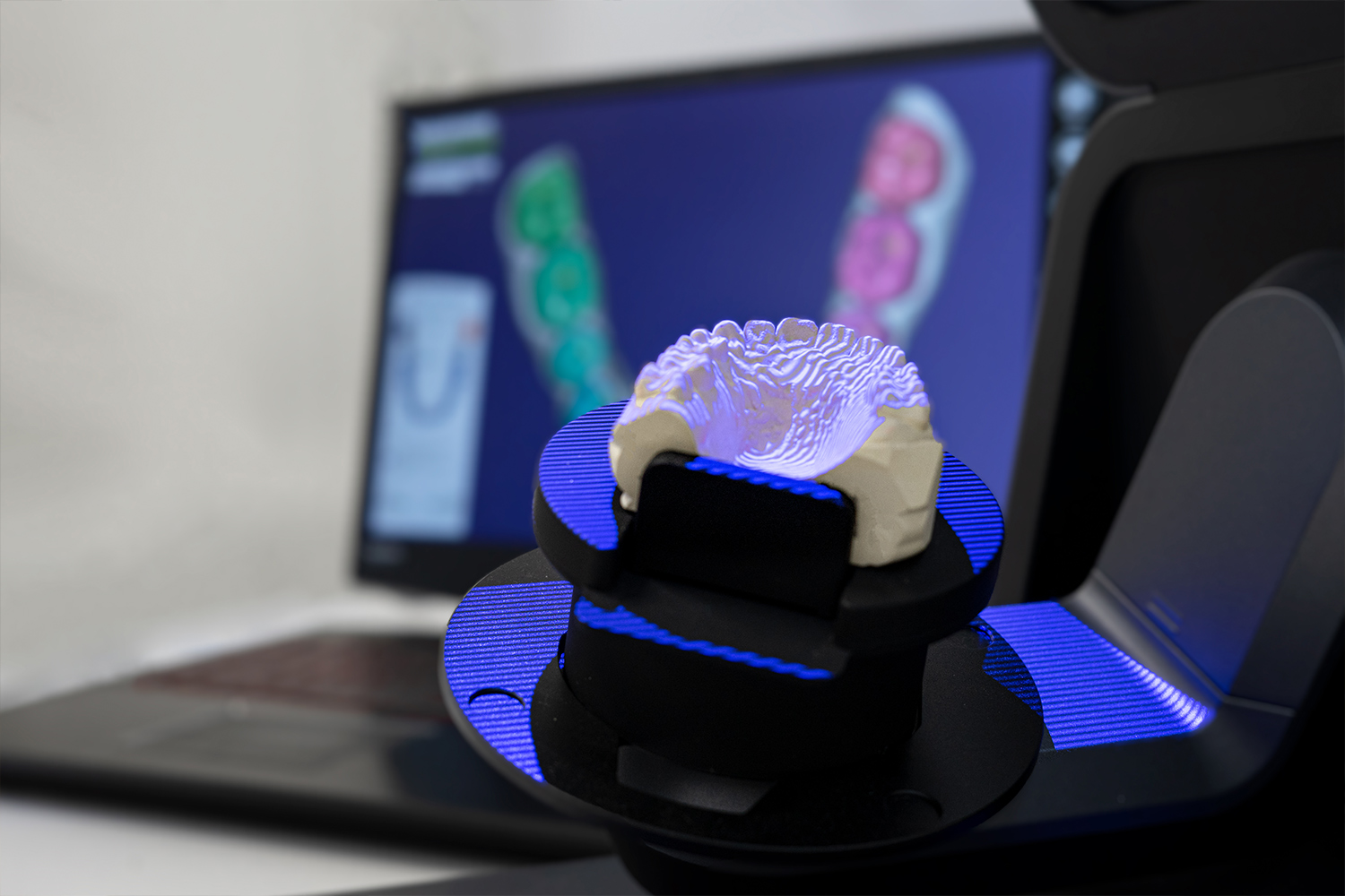 Dental 3D scanners