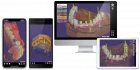 EXOCAD Dental CAD Labo pour les prothésistes - Licence Perpétuelle