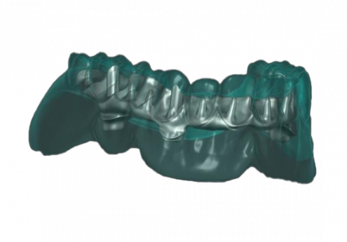 Formation CAO Dentaire Exocad : constructions implanto-portées