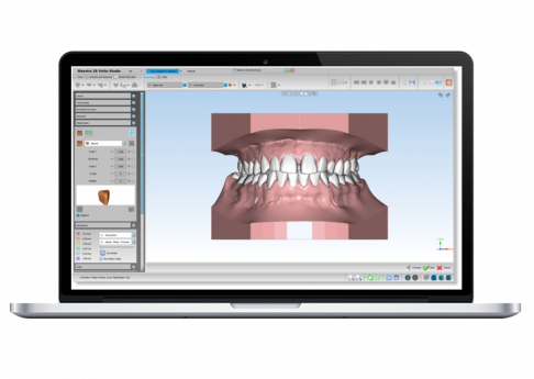 Logiciel d'orthodontie Maestro 3D - Configuration A
